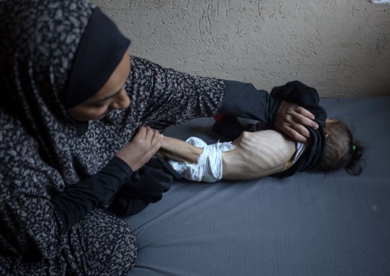 رضيعة فلسطينية تموت جوعا بين ذراعي أمها في غزة المحاصرة 2