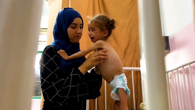 الطفلة ميار.. حصار غزة سرق وزنها وصوتها 1 أسماء العرجا والطفلة ميار