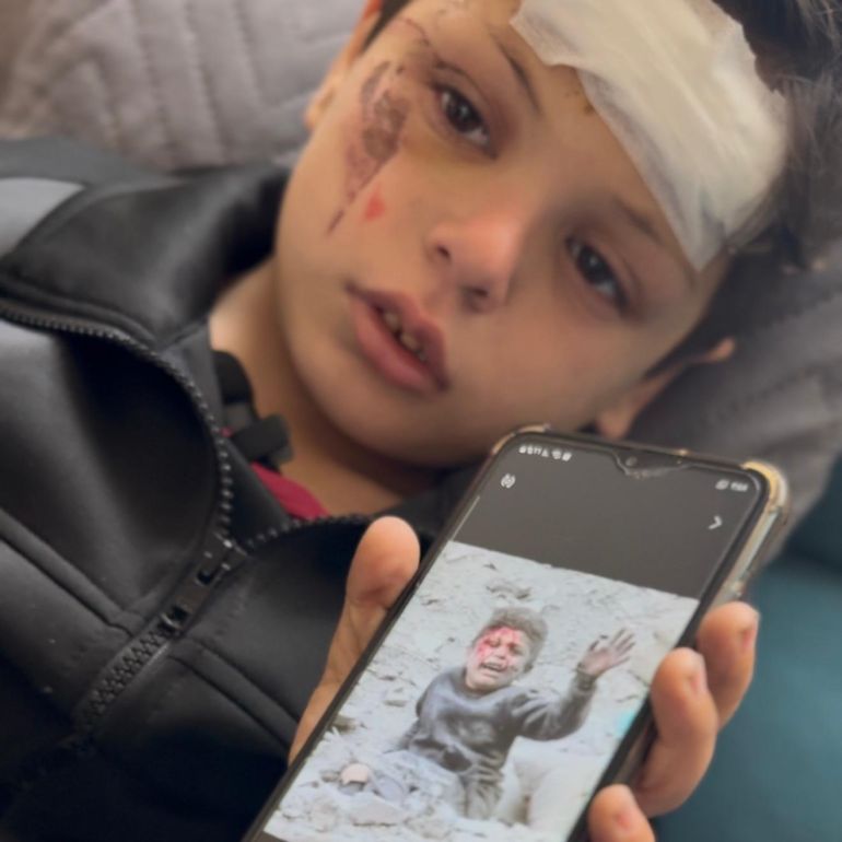في غزة.. طفولة معذبة تحت سياط الحرب 4 **داخلية*** الطفل علي فرج الذي تداول له النشطاء مقطعا مصورا حين قذفته الغارة على سطح المنزل المجاور بعدما فقد ١٩ فردا من عائلته، برفقة أمه