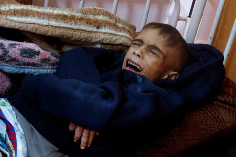 غزة تنزف بلا ضماد.. كارثة صحية في زمن التجاهل الدولي 2